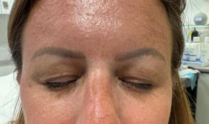 Semi Permanent Eyebrows — before