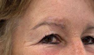 Semi Permanent Eyebrows — before