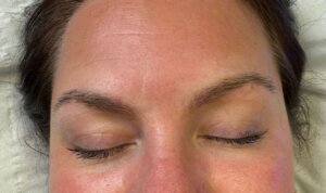 Semi Permanent Eyebrows — before