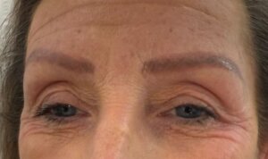 Semi Permanent Eyebrows — before
