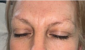 Semi Permanent Eyebrows — before